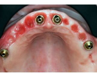 Scan-based digital dentistry