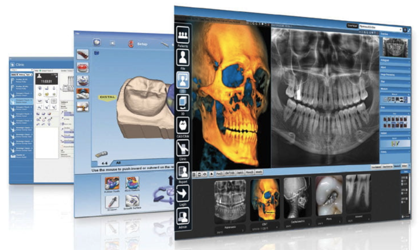 Digital implant planning